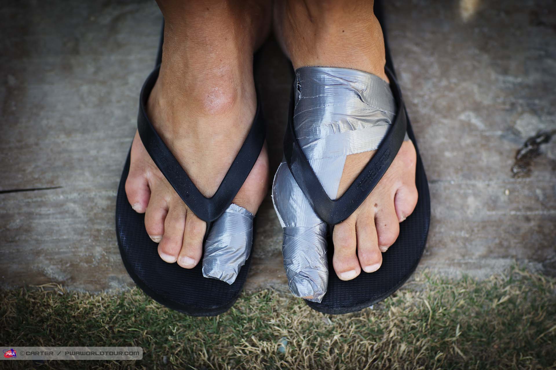 Steve Allen war wounds