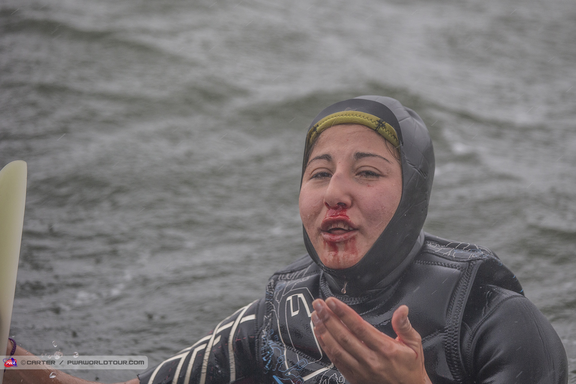Fulya injured